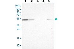 Western blot analysis of Lane 1: RT-4, Lane 2: U-251 MG, Lane 3: Human Plasma, Lane 4: Liver, Lane 5: Tonsil with NSUN7 polyclonal antibody  at 1:100-1:250 dilution. (NSUN7 anticorps)
