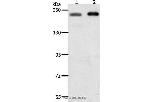 Western blot analysis of Hela and Jurkat cell, using SMARCA4 Polyclonal Antibody at dilution of 1:700 (SMARCA4 anticorps)