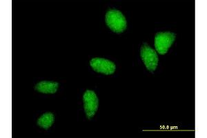 Immunofluorescence of monoclonal antibody to UBE2C on HeLa cell. (UBE2C anticorps  (AA 1-179))