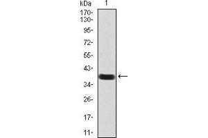 Western blot analysis using PAX6 mAb against human PAX6 (AA: 1-122) recombinant protein. (PAX6 anticorps  (AA 1-122))
