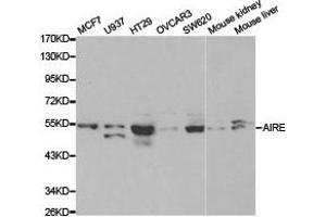 Western Blotting (WB) image for anti-Autoimmune Regulator (AIRE) antibody (ABIN1870889) (AIRE anticorps)