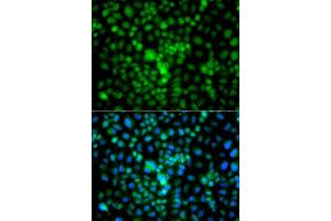 Immunofluorescence analysis of A549 cell using CIDEA antibody.