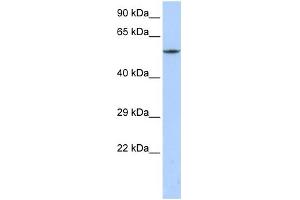 WB Suggested Anti-CACNB1 Antibody Titration:  0. (CACNB1 anticorps  (C-Term))