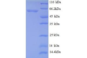 SDS-PAGE (SDS) image for Angiopoietin 2 (ANGPT2) (AA 19-483), (partial) protein (His tag) (ABIN5713064)