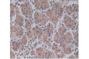 DAB staining on IHC-P; Samples: Human Stomach Tissue. (TLR5 anticorps  (AA 693-858))