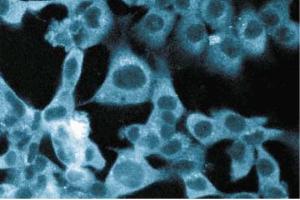 Immunofluorescent staining of ES2 cells. (STRAP anticorps  (AA 42-154))