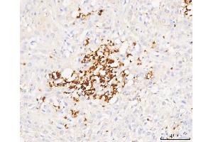 IHC analysis of Grancalcin/GCA using anti-Grancalcin/GCA antibody (ABIN6719568). (Grancalcin anticorps  (AA 42-217))