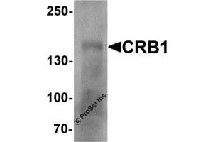 Western Blotting (WB) image for anti-Crumbs Homolog 1 (CRB1) antibody (ABIN1077415) (CRB1 anticorps)
