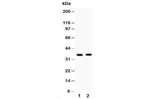 Western blot testing of HSD17B6 antibody and Lane 1:  human placenta;  2: MCF-7;  Predicted size: 35KD;  Observed size: 35KD (HSD17B6 anticorps  (C-Term))