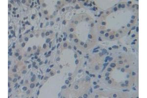 Detection of TOR1A in Human Kidney Tissue using Polyclonal Antibody to Torsin 1A (TOR1A)