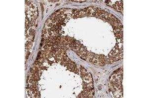 Immunohistochemical staining of human testis with FAXC polyclonal antibody  shows strong cytoplasmic positivity in cells in seminiferus ducts at 1:200-1:500 dilution. (C6orf168 anticorps)