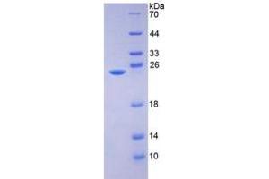 SDS-PAGE of Protein Standard from the Kit (Highly purified E. (AMBP Kit ELISA)