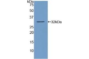 Detection of Recombinant AMY2, Human using Polyclonal Antibody to Amylase, Alpha 2A (AMY2A)