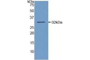 Detection of Recombinant AMY2, Human using Polyclonal Antibody to Amylase, Alpha 2A (AMY2A) (AMY2A anticorps  (AA 188-432))