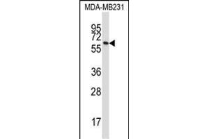 BTN3A1 Antibody (C-term) (ABIN657422 and ABIN2846459) western blot analysis in MDA-M cell line lysates (35 μg/lane). (BTN3A1 anticorps  (C-Term))