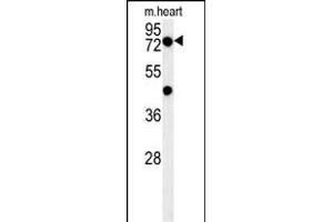 PHTF2 Antibody (Center) (ABIN654395 and ABIN2844137) western blot analysis in mouse heart tissue lysates (15 μg/lane). (PHTF2 anticorps  (AA 420-448))