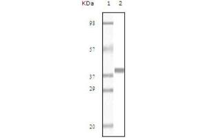Western blot analysis using Myoglobin antibody against truncated Myoglobin recombinant protein (AA: 2-154). (Myoglobin anticorps)