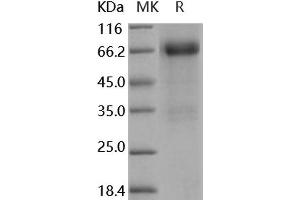 Western Blotting (WB) image for Follistatin (FST) (Active) protein (Fc Tag) (ABIN7320424)