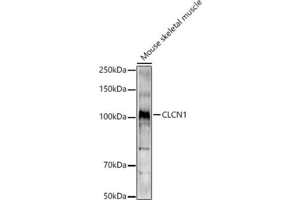 CLCN1 antibody  (AA 779-988)