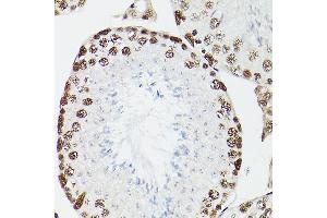 Immunohistochemistry of paraffin-embedded rat testis using CPSF6 Rabbit pAb (ABIN6128924, ABIN6138974, ABIN6138975 and ABIN6221646) at dilution of 1:100 (40x lens).