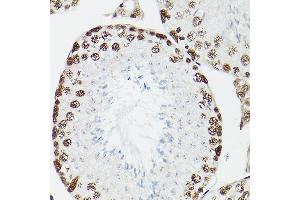 Immunohistochemistry of paraffin-embedded rat testis using CPSF6 Rabbit pAb (ABIN6128924, ABIN6138974, ABIN6138975 and ABIN6221646) at dilution of 1:100 (40x lens). (CPSF6 anticorps)