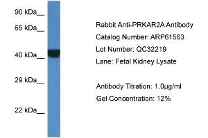 Western Blotting (WB) image for anti-Protein Kinase, CAMP-Dependent, Regulatory, Type II, alpha (PRKAR2A) (Middle Region) antibody (ABIN2788839) (PRKAR2A anticorps  (Middle Region))