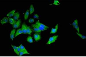Immunofluorescent analysis of Hela cells using ABIN7174579 at dilution of 1:100 and Alexa Fluor 488-congugated AffiniPure Goat Anti-Rabbit IgG(H+L) (UBE2L6 anticorps  (AA 13-153))