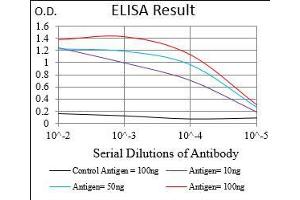 Black line: Control Antigen (100 ng), Purple line: Antigen(10 ng), Blue line: Antigen (50 ng), Red line: Antigen (100 ng),