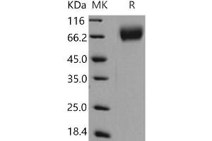 Western Blotting (WB) image for Neurotrophic Tyrosine Kinase, Receptor, Type 2 (NTRK2) (Active) protein (His tag) (ABIN7320394) (TRKB Protein (His tag))
