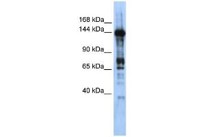 WB Suggested Anti-CASZ1 Antibody Titration:  0. (CASZ1 anticorps  (Middle Region))