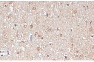 Immunohistochemistry of paraffin-embedded Rat brain using NAA20 Polyclonal Antibody at dilution of 1:100 (40x lens). (NAT5 anticorps)
