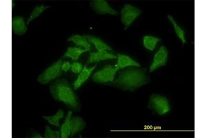Immunofluorescence of monoclonal antibody to ANKRA2 on HeLa cell.