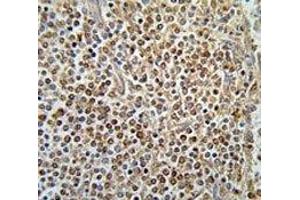 PAX-7 antibody immunohistochemistry analysis in formalin fixed and paraffin embedded human spleen tissue