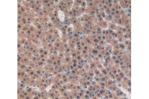 IHC-P analysis of liver tissue, with DAB staining. (beta-Thromboglobulin anticorps  (AA 46-107))
