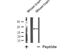 Western blot analysis of MARCKS expression in Mouse brain tissue lysates,The lane on the left is treated with the antigen-specific peptide. (MARCKS anticorps  (Internal Region))