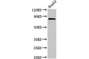 Western Blot Positive WB detected in: HepG2 whole cell lysate All lanes: NR3C1 antibody at 3 μg/mL Secondary Goat polyclonal to rabbit IgG at 1/50000 dilution Predicted band size: 86, 82, 65, 61, 83, 79, 77, 76, 52, 51, 50 kDa Observed band size: 86 kDa (Glucocorticoid Receptor anticorps  (AA 1-190))