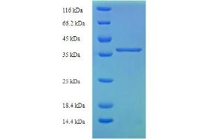 SDS-PAGE (SDS) image for Lysozyme-Like 1 (LYZL1) (AA 1-194) protein (His-SUMO Tag) (ABIN5711439)