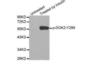 Western blot analysis of extracts from Jurkat cells using Phospho-DOK2-Y299 antibody (ABIN2987731). (DOK2 anticorps  (pTyr299))