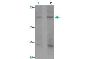 Western blot analysis of PELI1 in human liver tissue with PELI1 polyclonal antibody  at (1) 1 and (2) 2 ug/mL. (Pellino 1 anticorps  (C-Term))