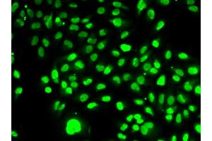 Immunofluorescence analysis of HeLa cells using NAMPT antibody. (NAMPT anticorps)