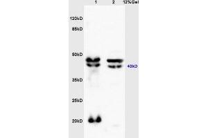 Lane 1: mouse brain lysates Lane 2: mouse kidney lysates probed with Anti Bdkrb2/B2R Polyclonal Antibody, Unconjugated (ABIN740040) at 1:200 in 4 °C.