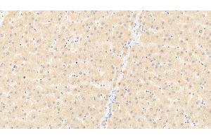 Detection of CD40L in Human Liver Tissue using Polyclonal Antibody to Cluster Of Differentiation 40 Ligand (CD40L) (CD40 Ligand anticorps  (AA 1-261))