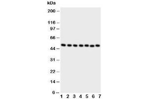 Western blot testing of CTBP2 antibody and Lane 1:  rat brain;  2: rat spleen ;  3: HeLa;  4: 293T;  5: COLO320;  6: U87;  7: SW620 cell lysate (CTBP2 anticorps  (C-Term))