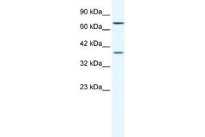 Western Blot showing ZNF660 antibody used at a concentration of 1-2 ug/ml to detect its target protein. (ZNF660 anticorps  (C-Term))