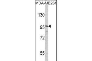 Western blot analysis of DLG Antibody (N-term) (ABIN390832 and ABIN2841058) in MDA-M cell line lysates (35 μg/lane). (DLGAP1 anticorps  (N-Term))