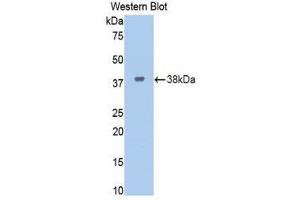 Western Blotting (WB) image for anti-Insulin Receptor (INSR) (AA 622-945) antibody (ABIN3207587) (Insulin Receptor anticorps  (AA 622-945))