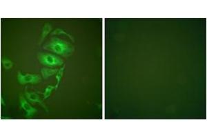 Immunofluorescence analysis of HepG2 cells, using Keratin 17 Antibody.