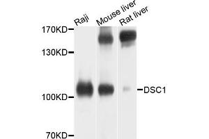 Western blot analysis of extracts of various cells, using DSC1 antibody. (Desmocollin 1 anticorps)