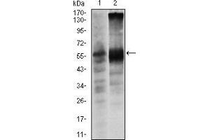Western blot analysis using SOX9 mouse mAb against Lovo (1) and SW620 (2) cell lysate. (SOX9 anticorps)