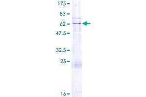 Image no. 1 for Katanin P60 (ATPase Containing) Subunit A 1 (KATNA1) (AA 1-311) protein (GST tag) (ABIN1308365)